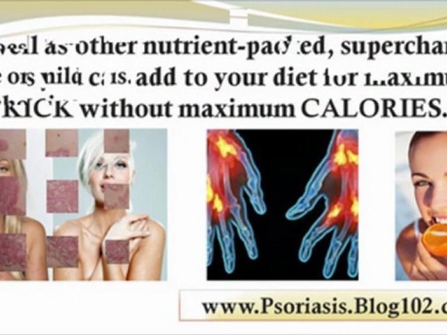 scalp psoriasis treatment – psoriasis scalp treatment – psoriasis home treatment