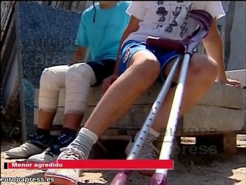 Unos perros atacan tres niños dejando a uno grave