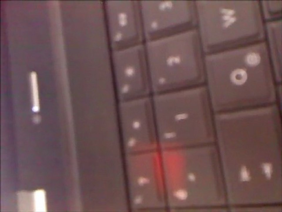 Sol yanım çok acıyor anne...