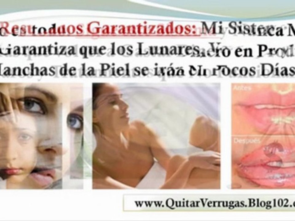 como quitar lunares - verrugas plantares - verrugas planas