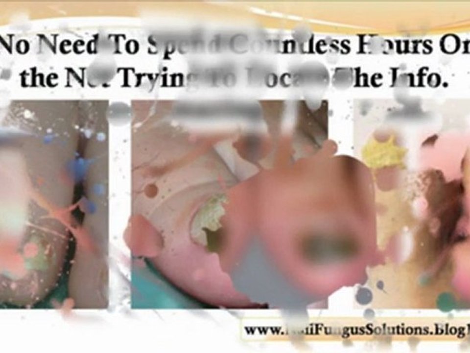 best nail fungus treatment - nail fungus home remedy - nail fungus treatments