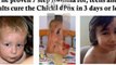 chicken pox treatment for children - chicken pox symptoms in adults - chicken pox contagious period