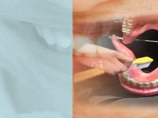 Brossage dentaire et  Ramadan