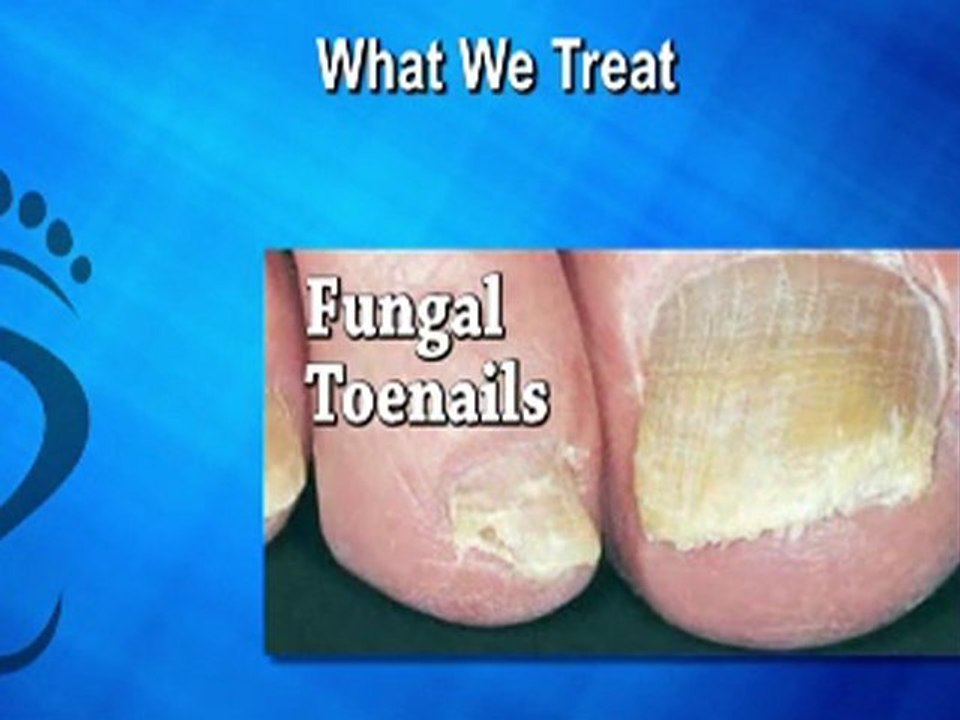 Podiatrist in Stratford, Turnersville and Swedesboro, NJ - S