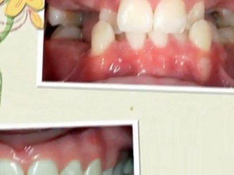 Orthodontist Parker CO New Smiles July 2011