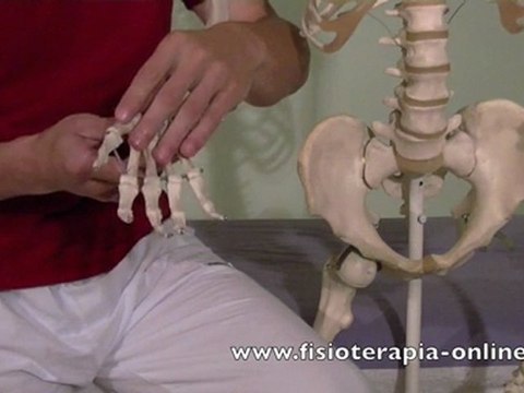 ¿Que es el Sindrome del tunel carpiano?