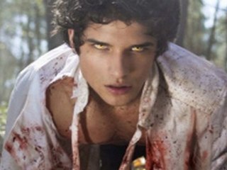Teen Wolf season 1 episode 4 Magic Bullet