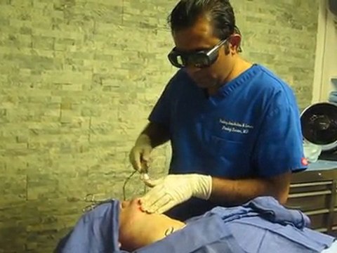 SmartLipo Laser Liposuction- Los Angeles County-Orange County-Riverside County-San Bernardino County-Inland Empire-Anaheim-Fullerton-Beverly Hills-Pasadena-Burbank-Hollywood-Cerritos-Long Beach-Irvine-Costa Mesa-Orange-Brea-Whittier-Pomona-Chino-Fontana