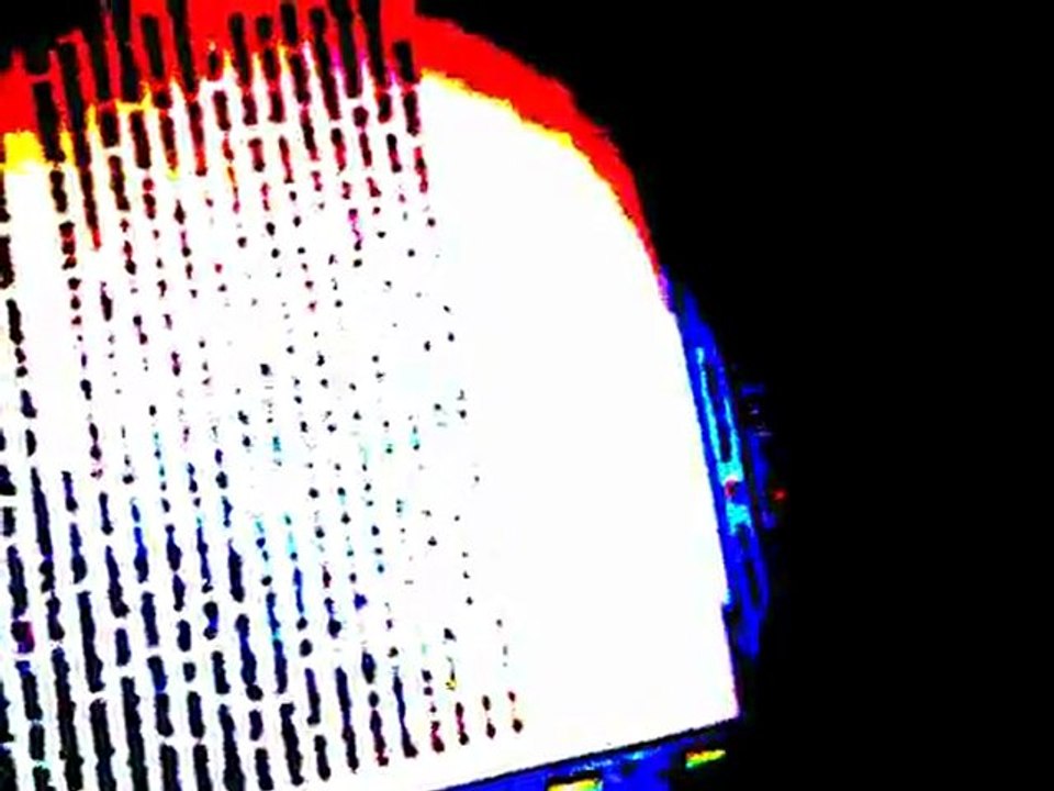 Sol Yanım Çok Acıyor Anne....