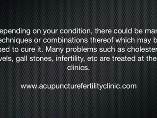 Arlington Acupuncture| All About Arlington Acupuncture