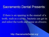 Sacramento Dental What is Abscessed Tooth?