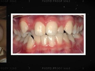 Westminster Orthodontics New Smiles July2011