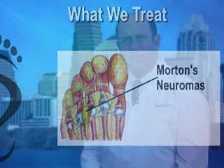 Podiatrist in Austin, TX - Dr. Michael Golf