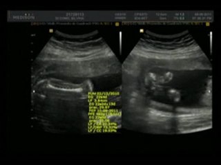 La flor más bella que jamás se haya creado