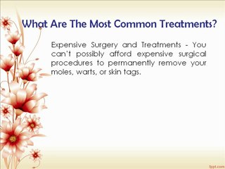 Moles, Warts & Skin Tags Removal
