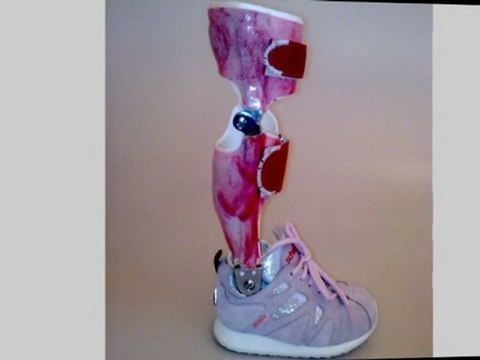 Reha Bingen Am Rhein SEIBT Innovative Orthopädietechnik