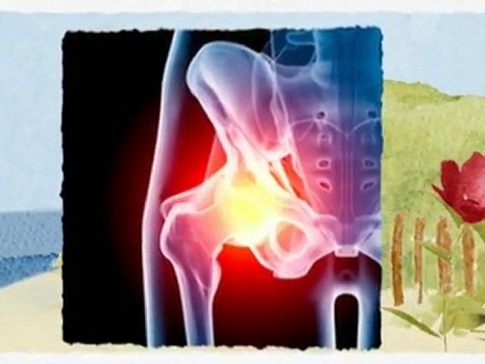 DePuy Hip Recall Lawsuit - Call Us for Legal Assistance