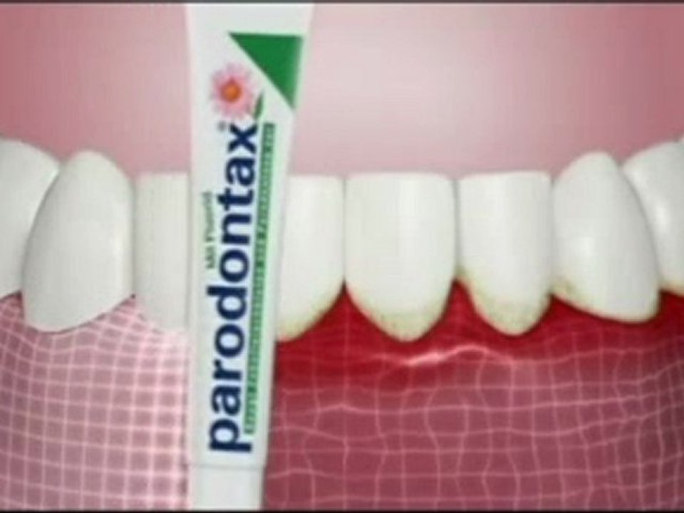 Parodontax Clip