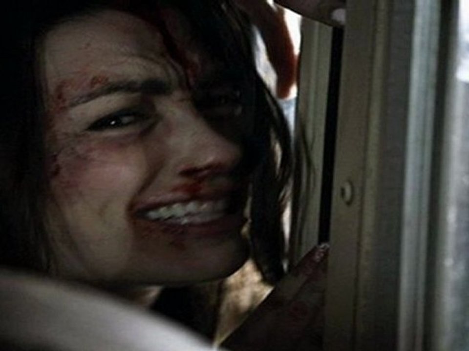 Teen Wolf season 1 episode 8 Lunatic