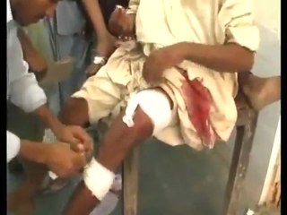 Pakistan hotel blast kills 11