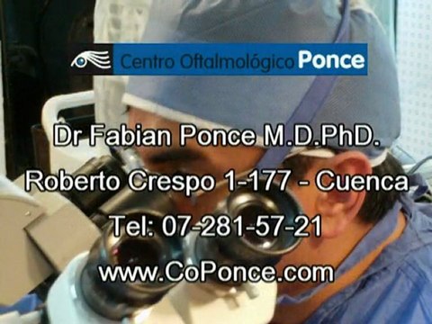 Catarata Cuenca Ecuador - Dr Fabian PONCE