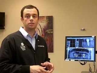 Why Do You Use Cone Beam 3D Analysis For Dental Implants?