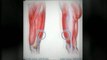 musculation cuisses