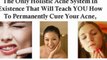 get rid of acne scars - acne scars treatment - acne home remedies