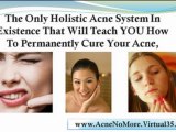 get rid of acne scars - acne scars treatment - acne home remedies