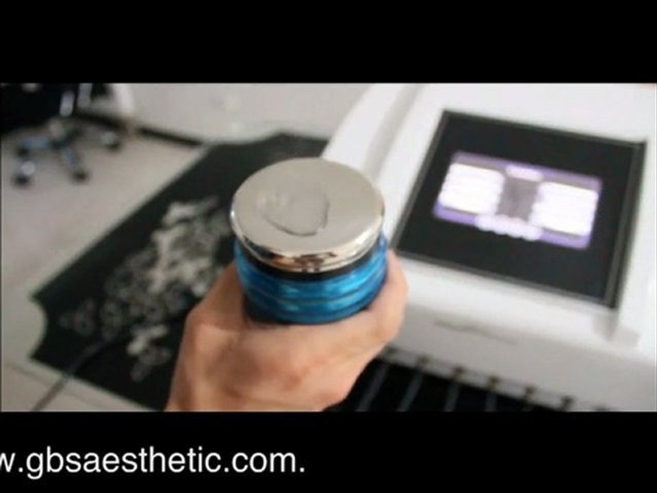 Slimming Cavitation With Bipolar RF and Tripolar RF Beauty Equipment