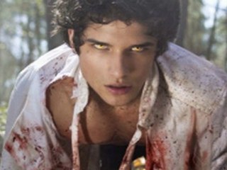 Teen Wolf season 1 episode 4 Magic Bullet ( FULL EPISODE )