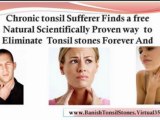 tonsillitis in children - tonsil stones treatment