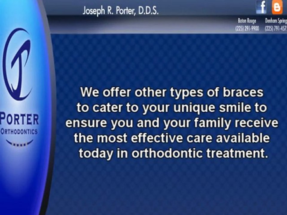Reliable Invisalign Baton Rouge