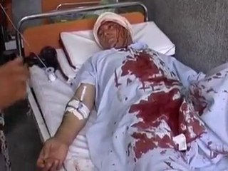 One dead and ten wounded in blast