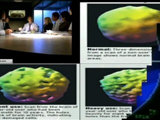 Dr. Eric Braverman Talks About Crystal Meth Addiction