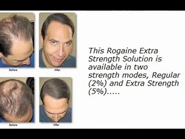 Rogaine For Men