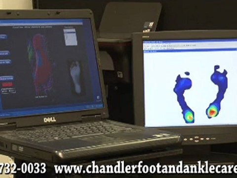 Custom Orthotics - Podiatrist in Chandler, Sun Lakes and Ph