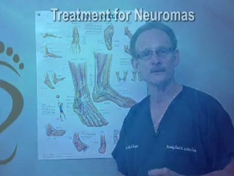 Morton’s Neuroma - Podiatrist in Chandler, Sun Lakes and