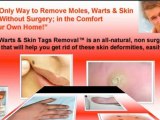 removing moles - removing skin tags - removing skin tags at home