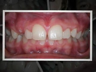 Aurora Orthodontics For You