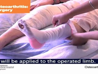 Knee Replacement Surgery - Singapore Health Video Series
