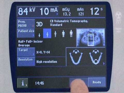 Promax 3D - Posicionamiento de los Senos