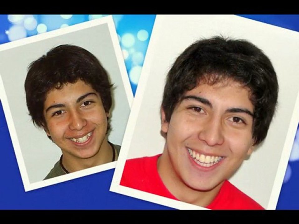 Antes y despues ortodoncia implantes dentales. Nuestros pacientes. Rosario