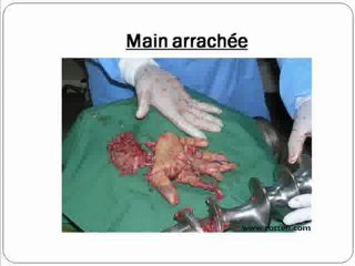 video accident 50 morts par jours