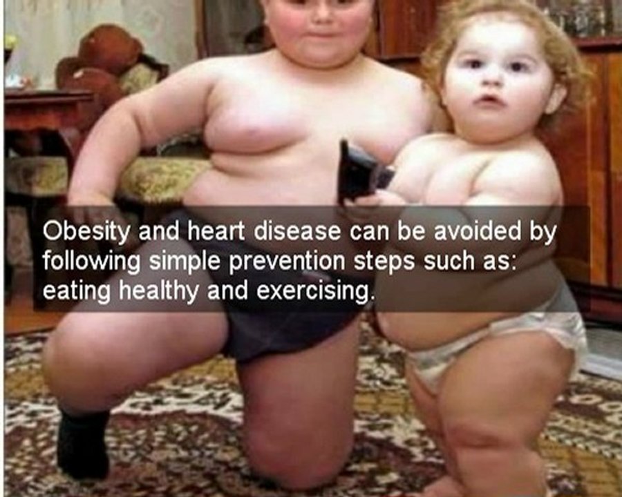 peripheral artery disease