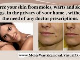 removing skin tags at home - remove skin tags yourself