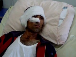 Ölü numarası yaparak kurtuldu!