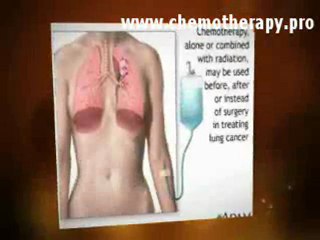 Cancer Chemotherapy