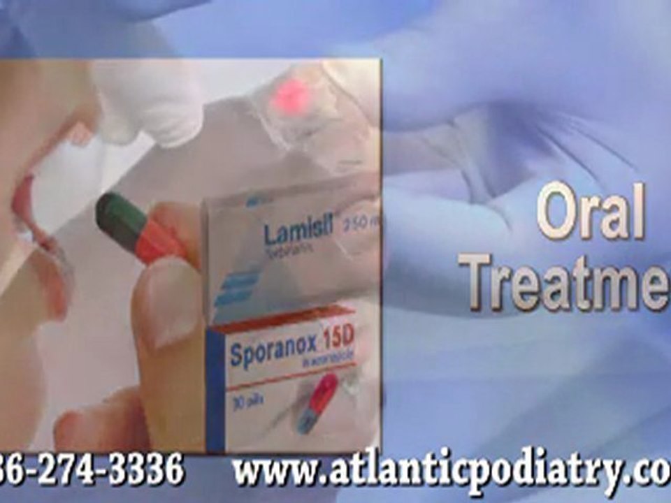 Toenail Fungus  - Podiatrist in Daytona Beach, Port Orange,