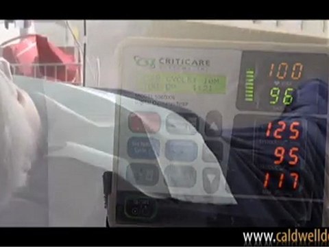 Sedation Dentistry - Caldwell DDS - Orange County, California